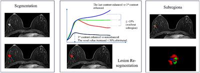 The value of the malignant subregion-based texture analysis in predicting the Ki-67 status in breast cancer